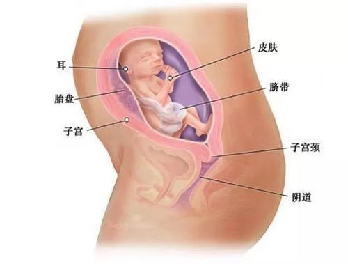 孕31周，脐带绕颈1周，怎么办？