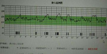 宝宝胎心高于160，怎么办？