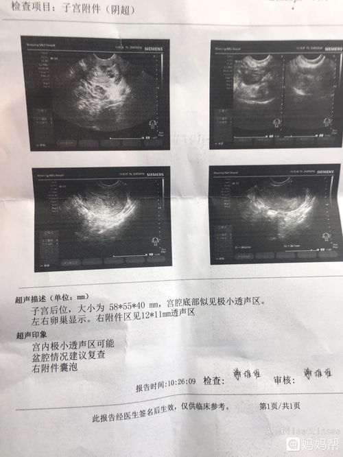 怀孕40天宫内宫外都看不到孕囊