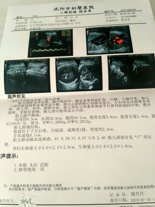 孕期做四维彩超宝宝的胎心心率多少是正常