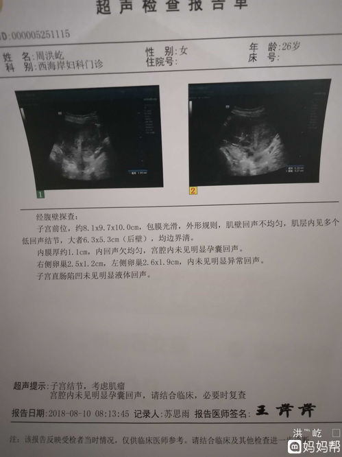 囊内探及回声，大小约10×5mm什么意思