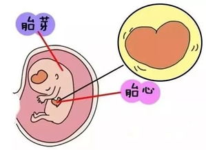 孕12周nt值正常范围图片