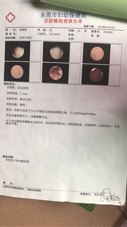 调经促孕丸可以治输卵管堵塞吗