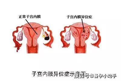 月经周期长排卵期也晚吗