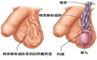 尖锐湿疣初期丘疹会痒吗