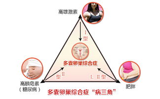 治疗多囊卵巢综合症的偏方