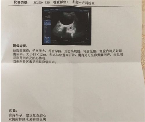 怀孕多久能看见卵黄囊