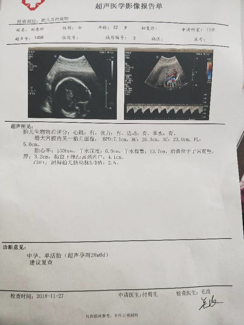 怀孕27-28周能做彩超吗