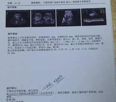 上海妇幼保健院做四维彩超多少钱