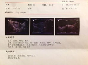 到底胎心150以上是女的还是男的