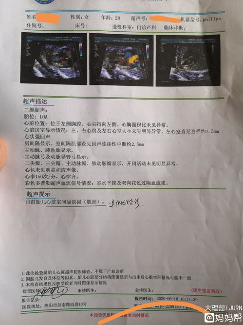 胎儿室间隔缺损严重不？