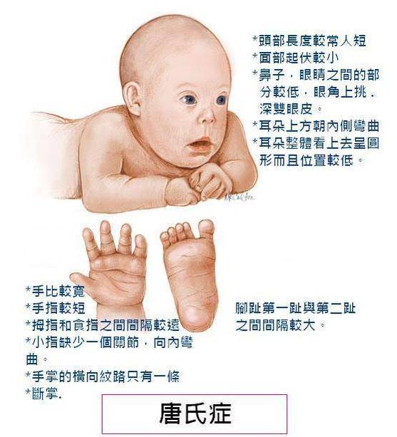 孕妇缺钙如何补钙