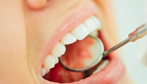 粘上的假牙和牙龈有缝隙会影响假牙的寿命吗