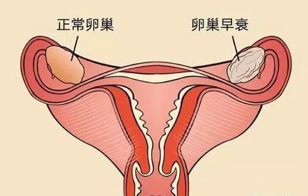 女人做卵巢保养有什么好处