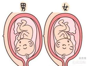 鉴定胎儿性别的方法