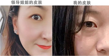 40岁的女人最容易缺什么营养