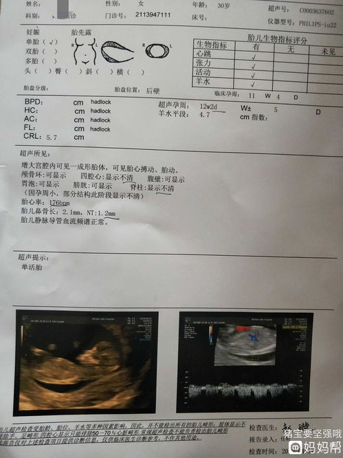 12周nt值为2.2mm正常吗