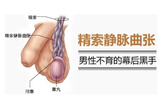 男性精索静脉曲张能自愈吗