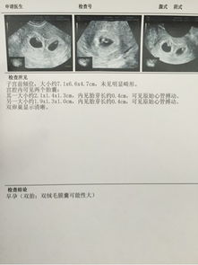 46天还没有胎芽正常吗，孕囊周围有少量积液就是先兆流产吗？