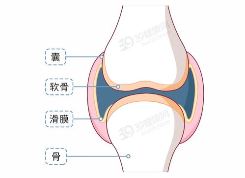 多运动可以改善多囊吗