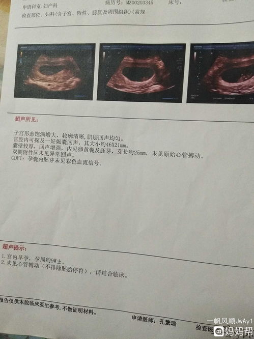 老婆怀孕七周多没有胎芽怎么办？