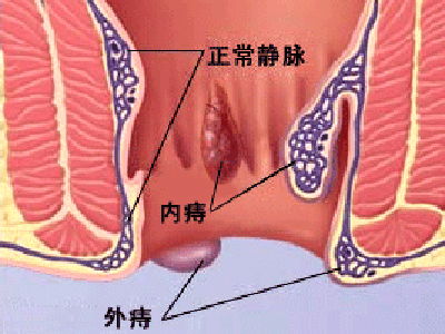 怎么治大便不畅通