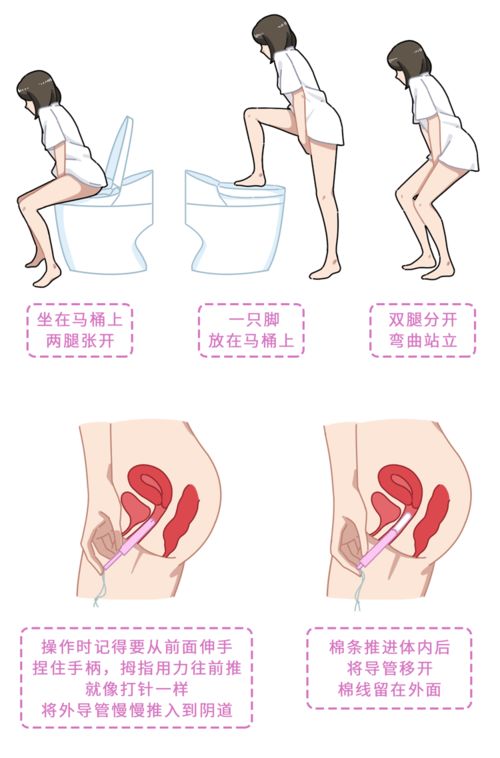 卫生棉条多久需要更换呢、我都是下面用一个护垫、等漏了我才去换掉、这样的做法正确吗、