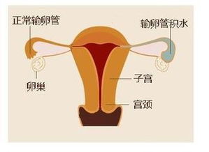 胚胎移植后上厕所有影响吗