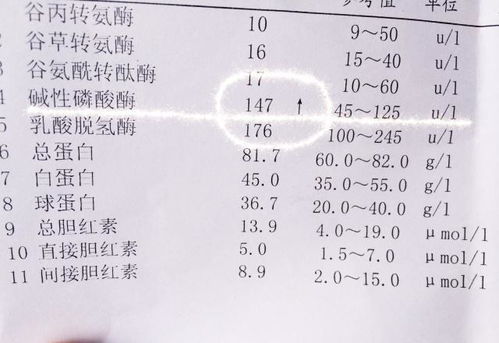 孕妇碱性磷酸酶正常值是多少啊