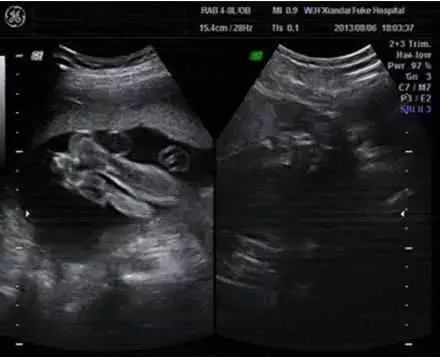怀孕各周胎儿图