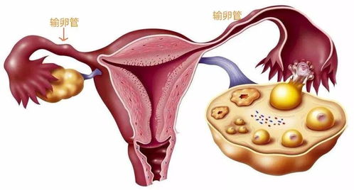 这个孕囊是长型还是圆型呢