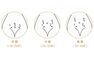 家用胎心仪找胎心技巧10周