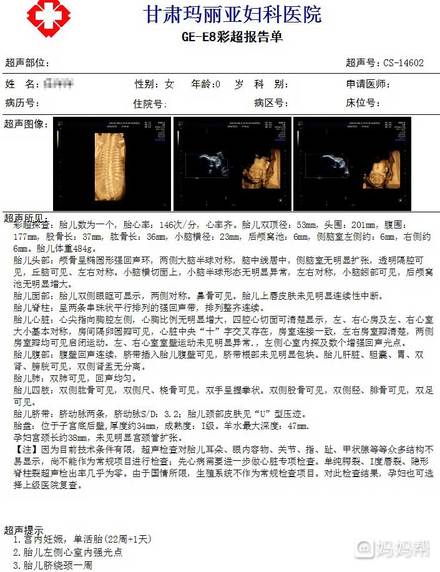 四维彩超需要预约吗