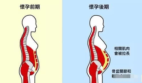 什么因素会导致假性怀孕