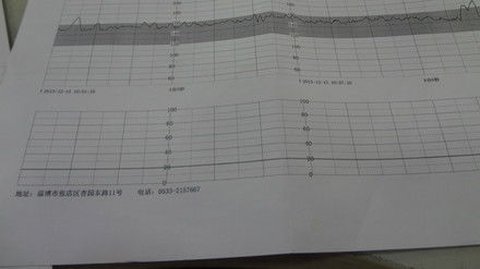 怀孕34周胎心监护不合格怎么办