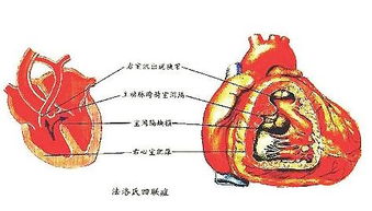 心脏病最多能活到什么时候