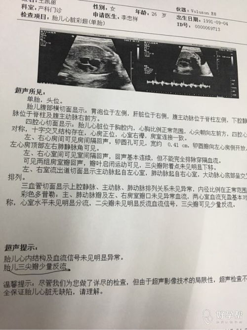 为什么胎儿会三尖瓣轻度返流