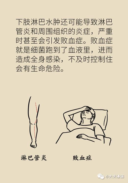 腿肿胀是不是怀孕了