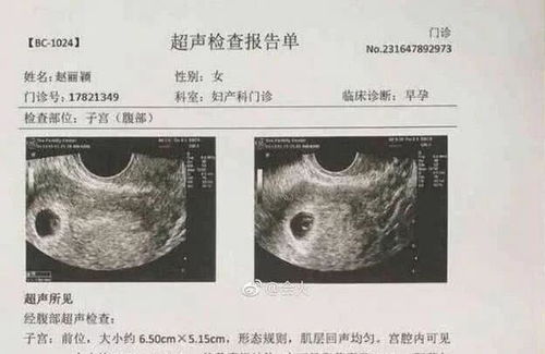 几个辨别胎儿性别的小知识