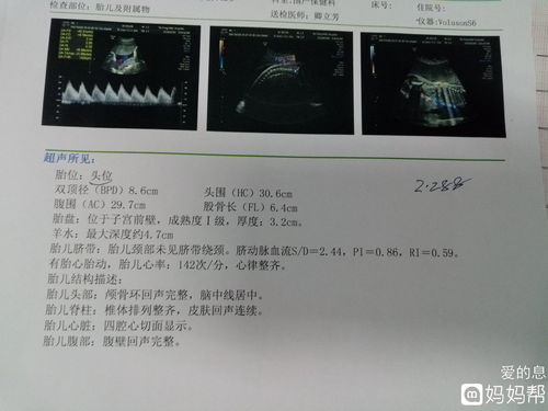 怀孕30周宝宝双顶径:7.5，股骨长径:5.6