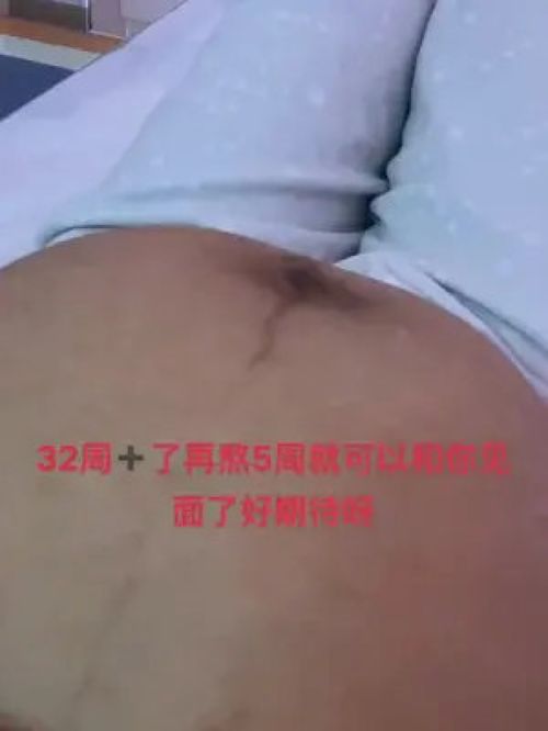 孕中期肚皮发紧发硬,该怎么缓解?