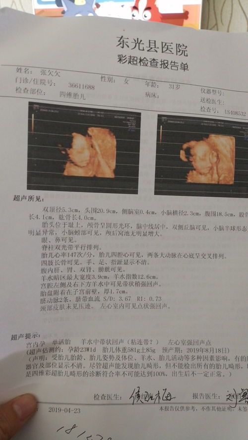 胎儿左右心室强光点生下来会怎样