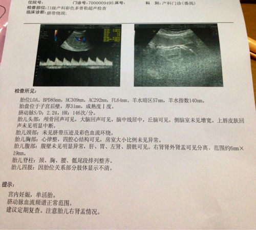 孕38周胎儿双肾见肾盂分离宽0.6cm。