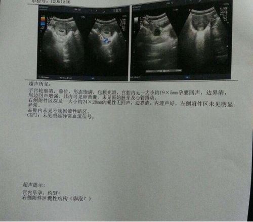 卵泡发育不良有什么症状