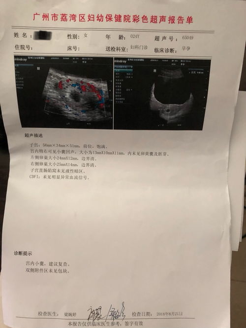 有没有怀孕54天可见卵黄囊未见胎芽和胎心的亲，