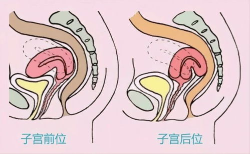 怀孕后最容易得什么病