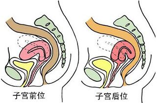 怀孕后最容易得什么病