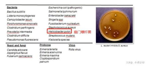 丽珠得乐治疗幽门螺杆菌的用法？