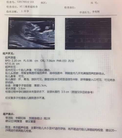 12周查出水囊瘤nt增厚13周水囊瘤吸收了畸形大吗