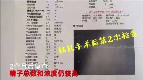 生育一个孩子结扎了要怎么向计生部门要证明在生